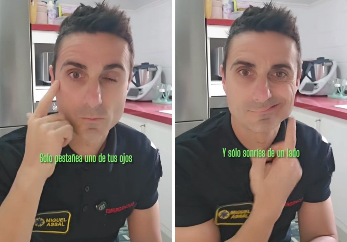 Un técnico de emergencias explica qué pasa cuando se te paraliza la cara: «Si tuviste varicela, puede reactivarse en cualquier momento»