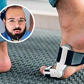 Un podólogo desmiente a los que usan correctores de juanetes