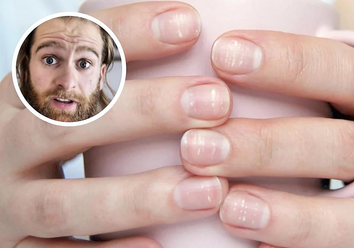 Un podólogo advierte sobre la verdadera causa de la aparición de manchas blancas en las uñas: «Se llama leuconiquia»