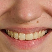 Un odontólogo explica por qué los dientes pueden verse amarillos incluso si se cepillan correctamente: «No es falta de higiene»