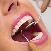 Un dentista explica qué no debes hacer si quieres conservar los dientes toda la vida