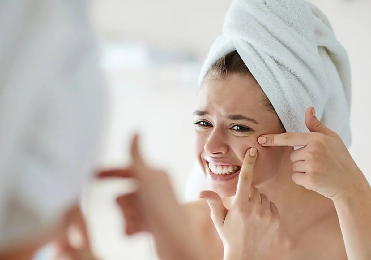 Una enfermera dermoestética explica cómo eliminar las manchas de acné