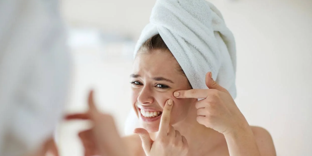 Una enfermera dermoestética explica cómo eliminar las manchas de acné: «Si no dejas de...»