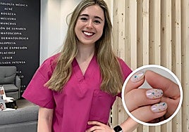 Una dermatóloga explica cuándo tienes que ir al médico por una uña: «Hay que descartar que sea...»