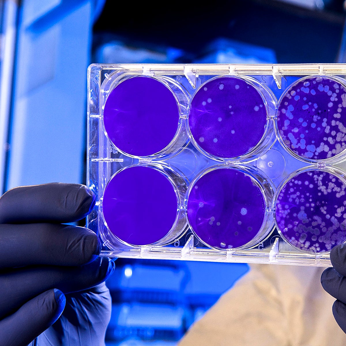 Un nuevo marcador genómico facilita la terapia dirigida para un tipo de cancer colorrectal metastásico