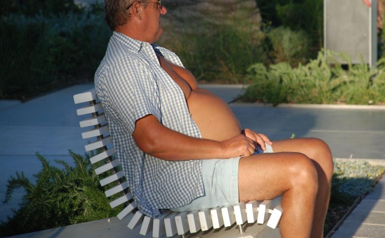 La obesidad es un grave problema de salud pública