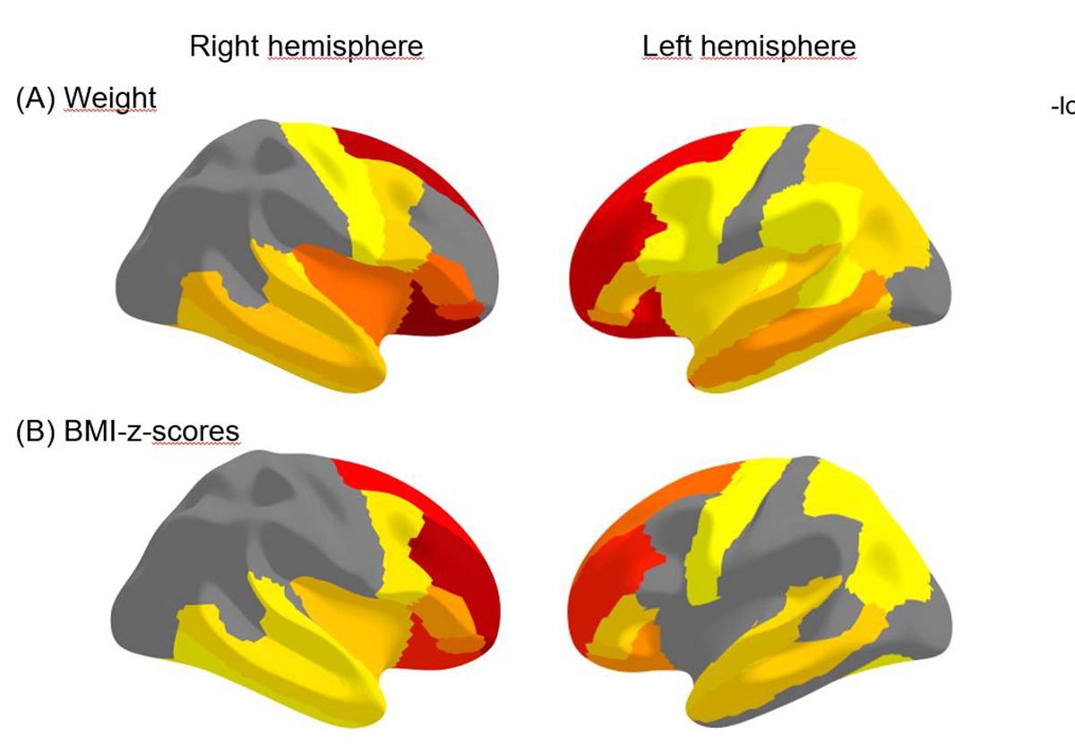 Distintos cerebros