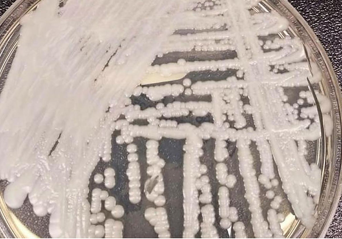Una cepa de Candida auris cultivada en una placa de Petri en los Centros para el Control y la Prevención de Enfermedades (CDC