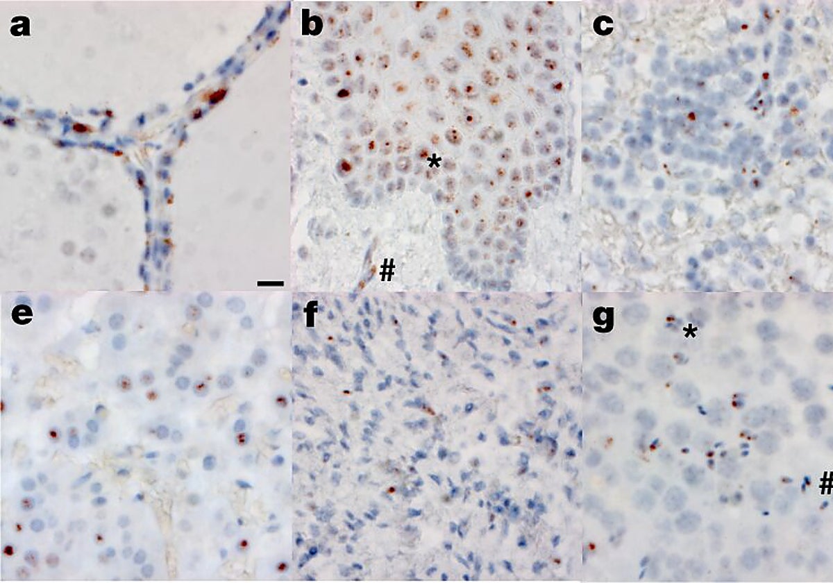 Covid-19 en diferentes tipos de tejidos