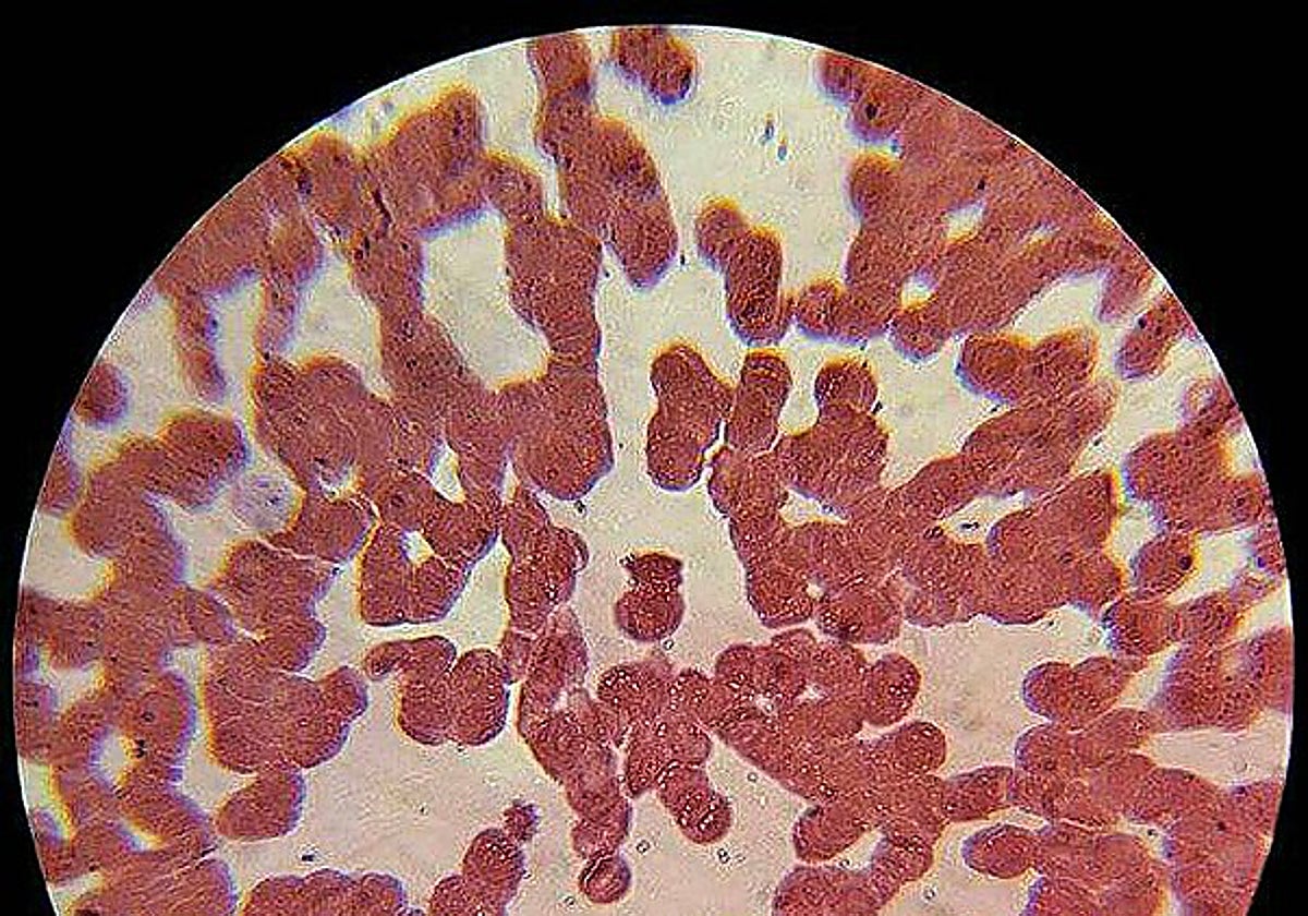 Células sanguíneas