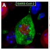 La vacuna del CNB-CSIC protege del covid-19 y del daño cerebral causado