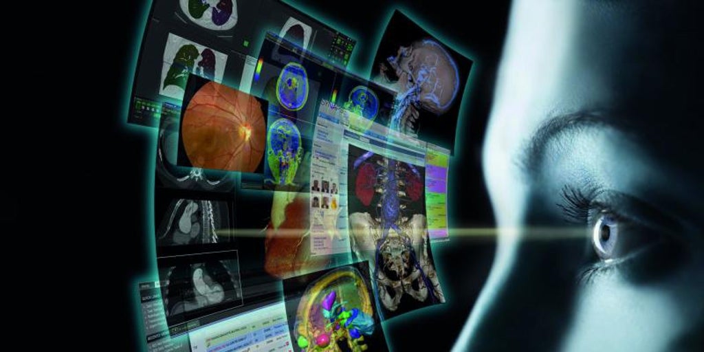 Inteligencia artificial aliada contra el cáncer de colon