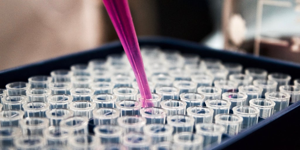Identifican un gen clave en el desarrollo y tratamiento del cáncer de páncreas