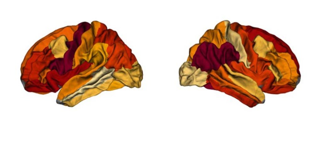 La obesidad puede provocar una neurodegeneración similar al alzheimer La obesidad puede provocar una neurodegeneración similar al alzheimer