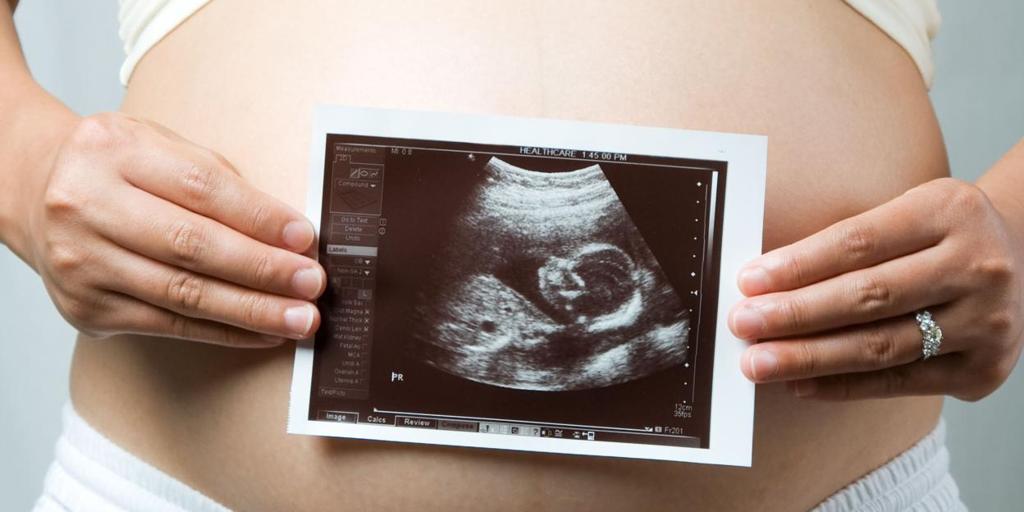 Beber alcohol antes ydurante el embarazo cambia la forma de la cara de los niños