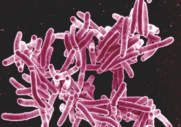 La tuberculosis se puede tratar en dos meses