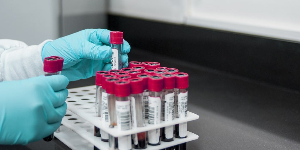 síntomas y cómo se contagia la enfermedad que se investiga en Valencia síntomas y cómo se contagia la enfermedad que se investiga en Valencia