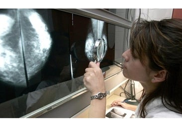 Descubren cómo desactivar la 'bomba de relojería' del cáncer de mama metastásico