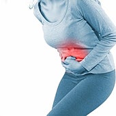 Los ginecólogos avisan: estos son los síntomas del cáncer de ovario