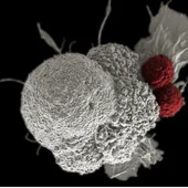 Dos estudios desvelan los secretos y debilidades de la metástasis en cáncer