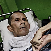 Esta variante genética protegió del alzhéimer durante 30 años