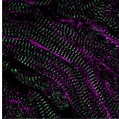 Esta molécula es clave para reparar un corazón dañado tras un infarto
