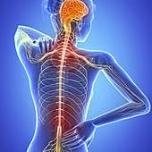 Por qué las mujeres con esclerosis múltiple mejoran durante el embarazo