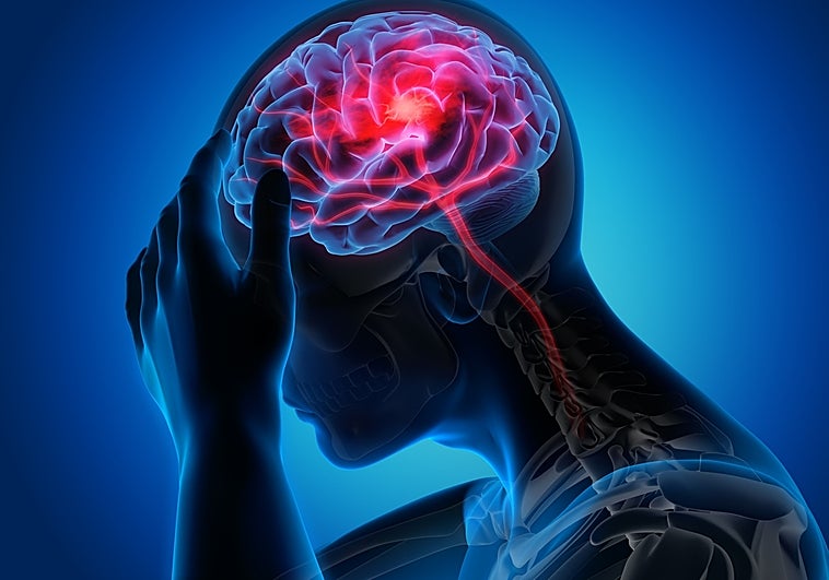 podcast |  Ictus, el infarto que no duele pero puede ser mortal