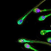 ¿Disminuye la calidad del semen tras sufrir una infección por covid?