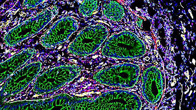 Células del intestino