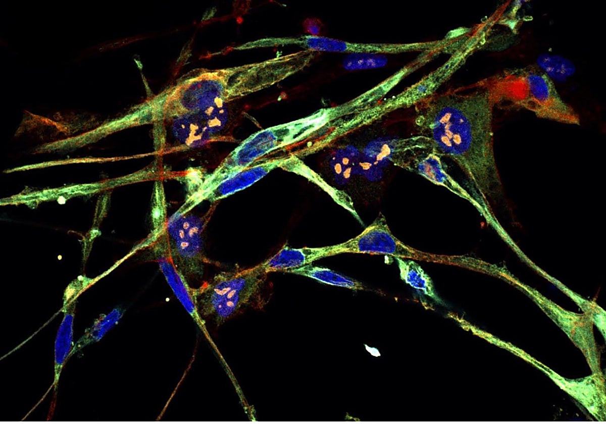 A medida que las células se transforman, adquieren características musculares típicas, incluida la forma fusiforme que se ve aquí.
