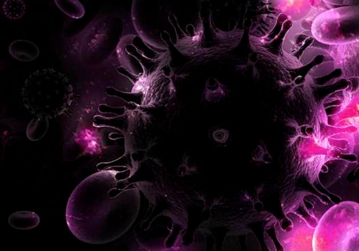 Virus que causa el sida