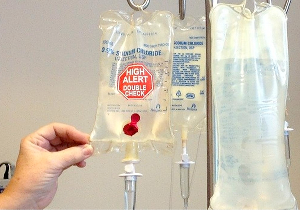 Una terapia experimental con células madre retrasa la progresión de la esclerosis múltiple en más de diez años