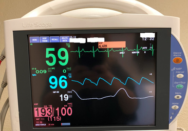 Un spray nasal controla las taquicardias