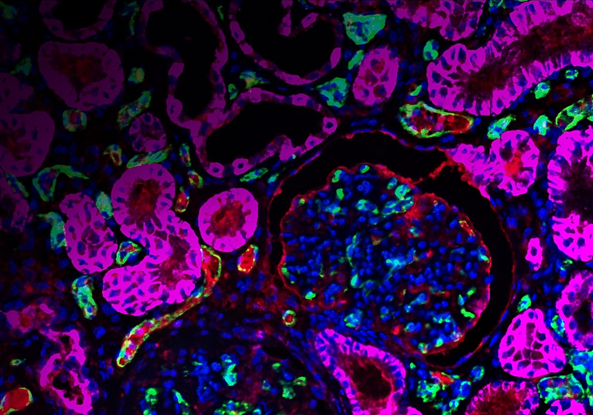 Verde: células endoteliales CD31+; fucsia, CD46 humano; C4d, rojo; azul, núcleo.
