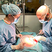 La terapia celular enseña al sistema inmunitario a tolerar los trasplantes de hígado