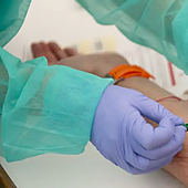 Un análisis de sangre detecta tumores en una etapa precoz en personas con riesgo genético