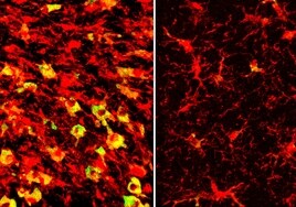 Reducir el 'colesterilo' controla el alzhéimer en ratones