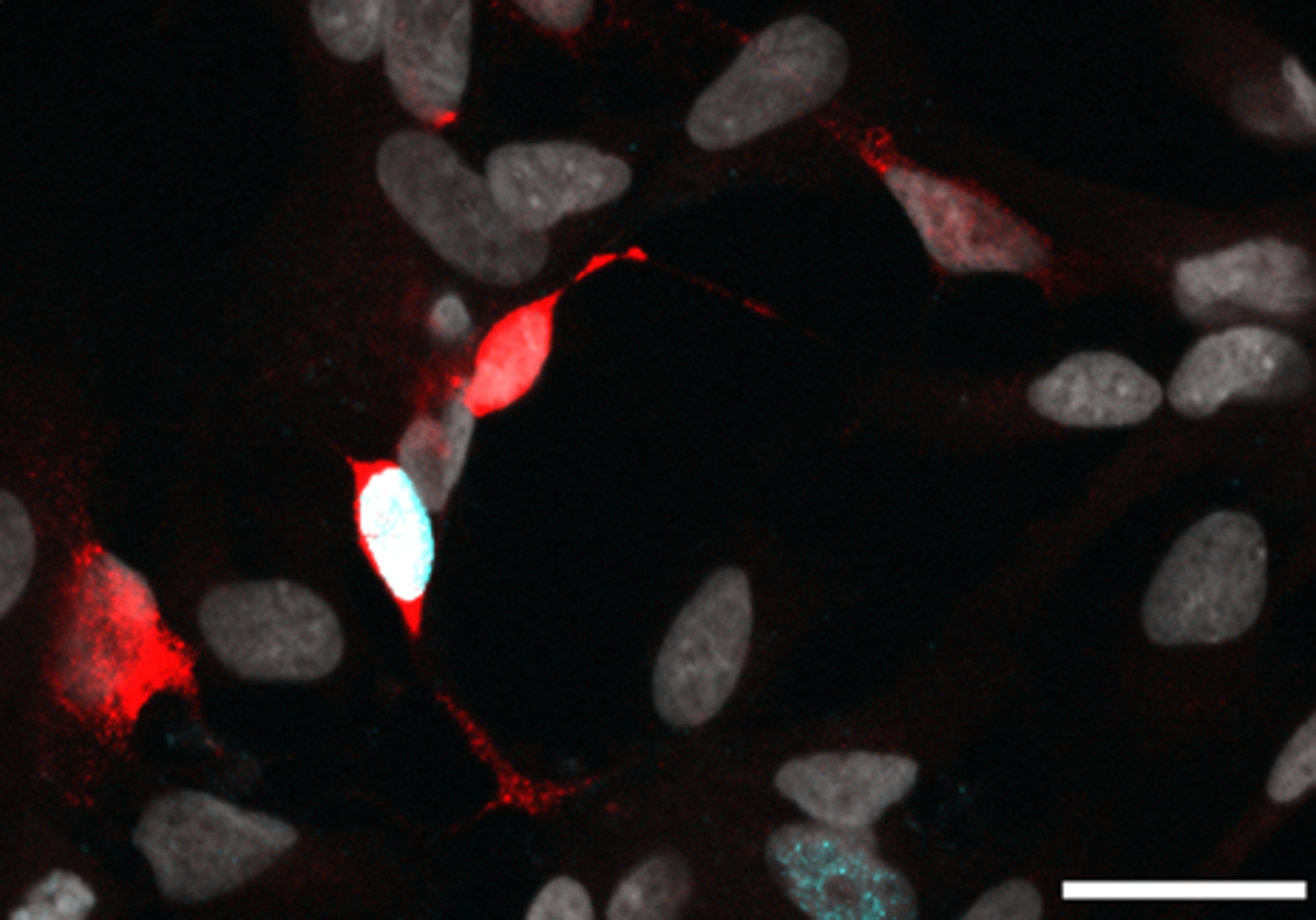 Un programa genético convierte células de la retina humana en neurona