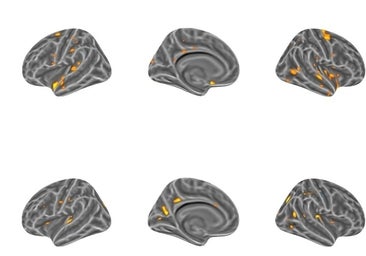 El cerebro de la mujer cambia durante el embarazo, parto y posparto