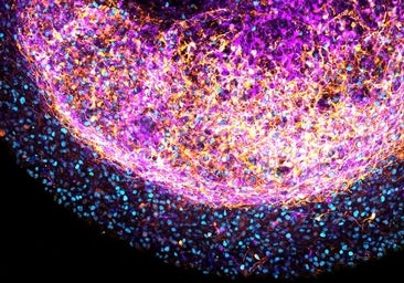 Diseñan organoides a partir de tejido cerebral fetal humano
