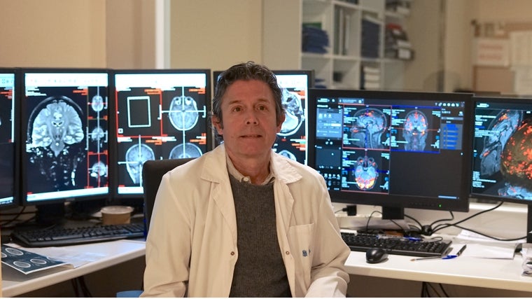 Juan Álvarez-Linera Prado, neurorradiólogo jefe del departamento de diagnóstico del Hospital Ruber Internacional