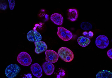 Una técnica caza las células del cáncer para que el sistema inmune las elimine
