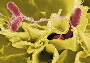 Las bacterias que influyen en la obesidad son diferentes en hombres y mujeres