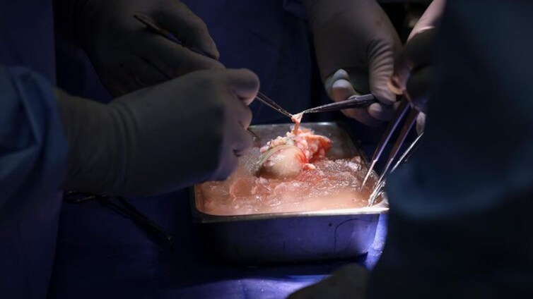 El primer paciente trasplantado con un riñón de cerdo recibe el alta
