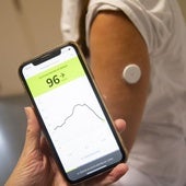 La moda de los sensores de glucosa en personas sin diabetes: ¿tiene sentido medir los picos de azúcar?