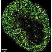 Una IA diferencia entre células cancerosas y normales