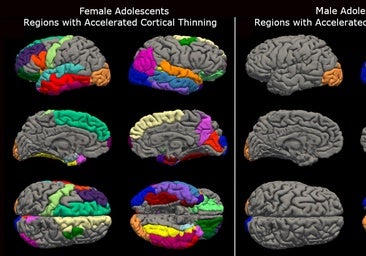 Las adolescentes envejecieron sus cerebros más de cuatro años durante el confinamiento por covid