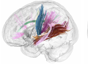 Así cambia el cerebro antes, durante y después del embarazo humano