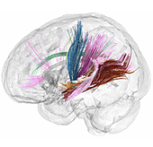 Así cambia el cerebro antes, durante y después del embarazo humano